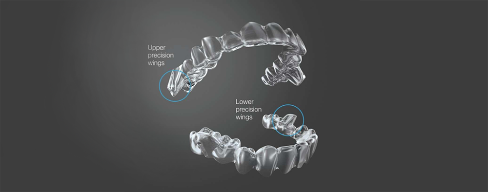 Invisalign thiết kế riêng: Toàn tập về Invisalign